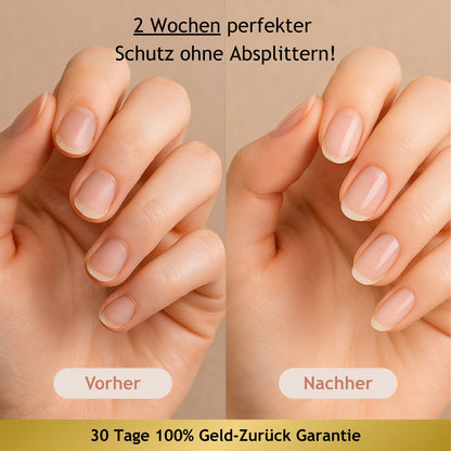 NailProtect UV-Stripes