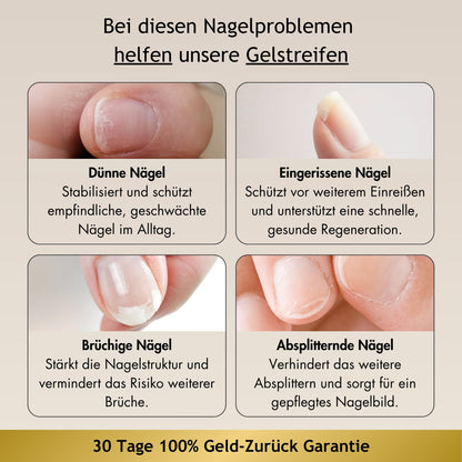 NailProtect UV-Stripes